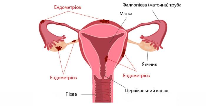 Восстановление менструального цикла после аборта