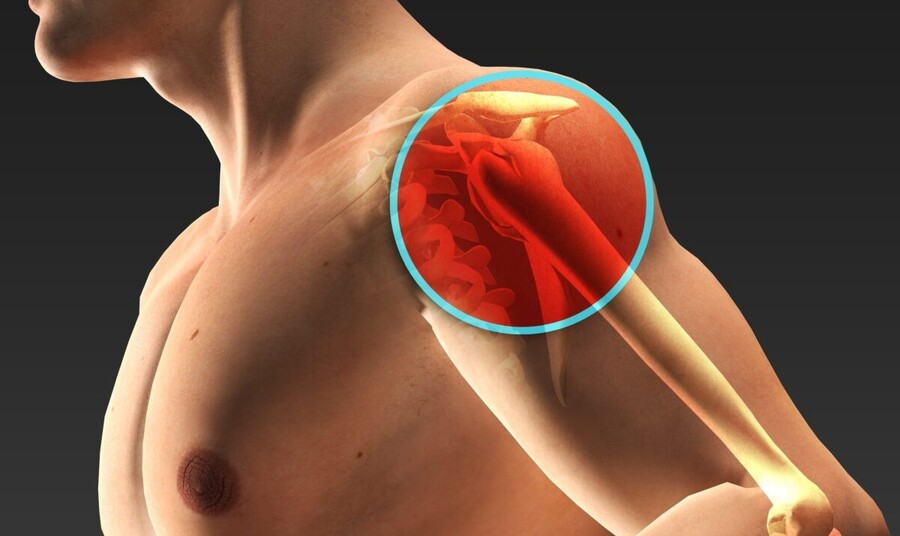 Реабилитация плечевого сустава