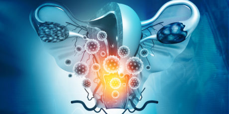 Діагностика раку піхви
