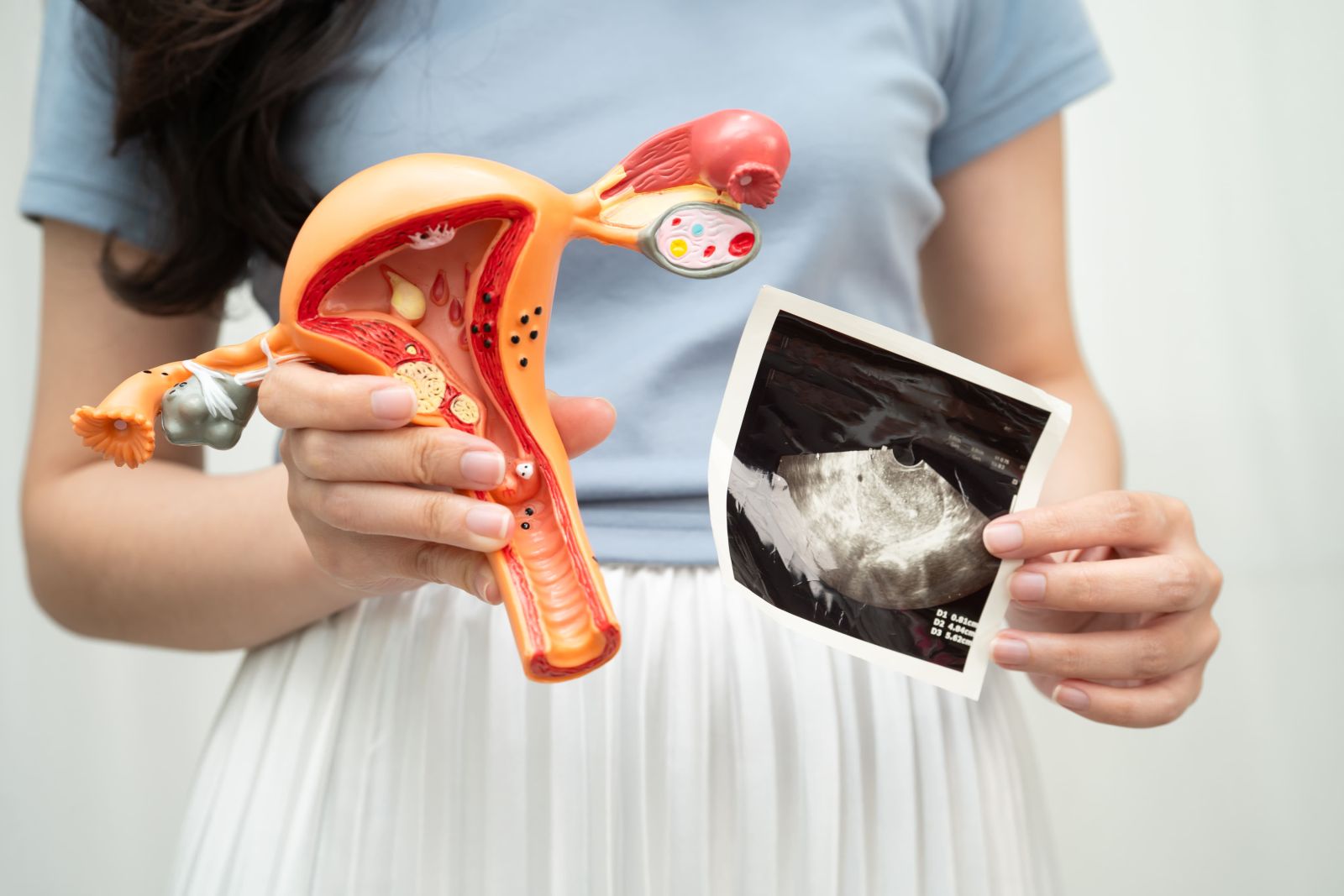 бесплодие у женщин