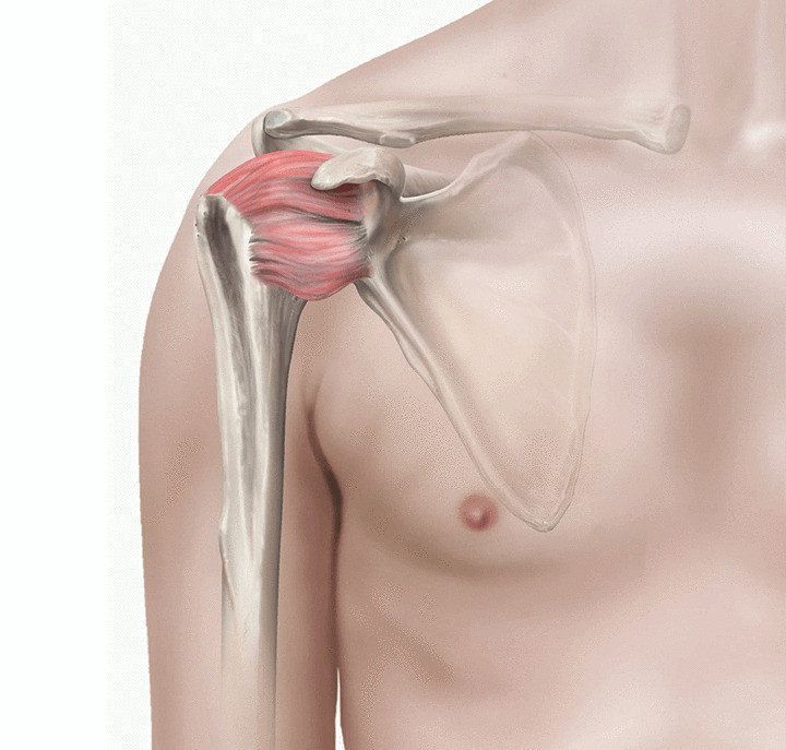 Адгезивний капсуліт (синдром «замороженого» плеча)