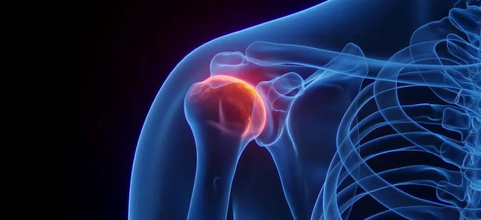 адгезивний капсуліт причини