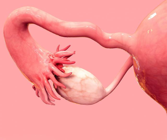 Рак маточных труб