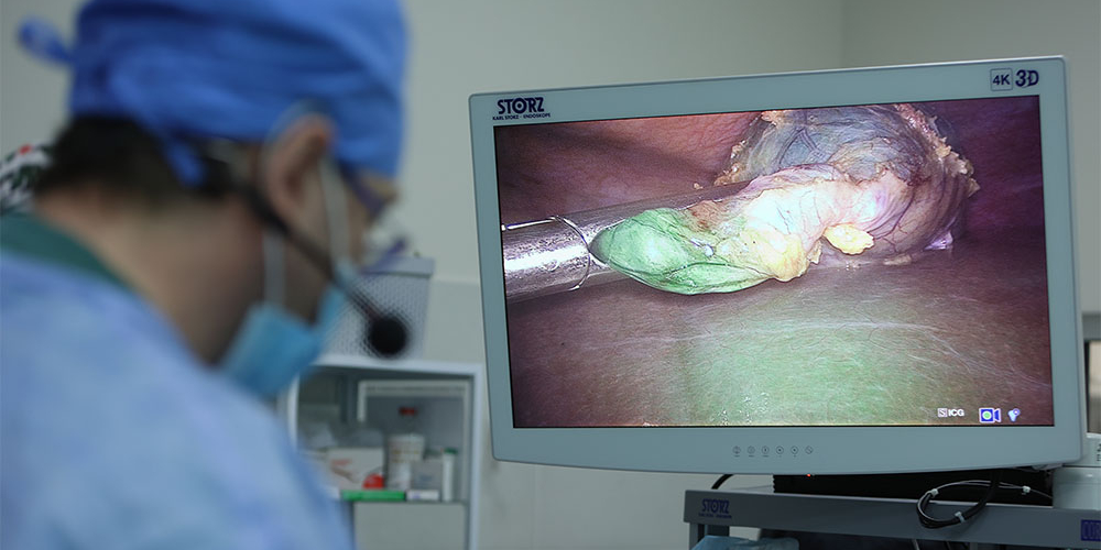 ICG-лапароскопія (флуоресцентна лапароскопія)