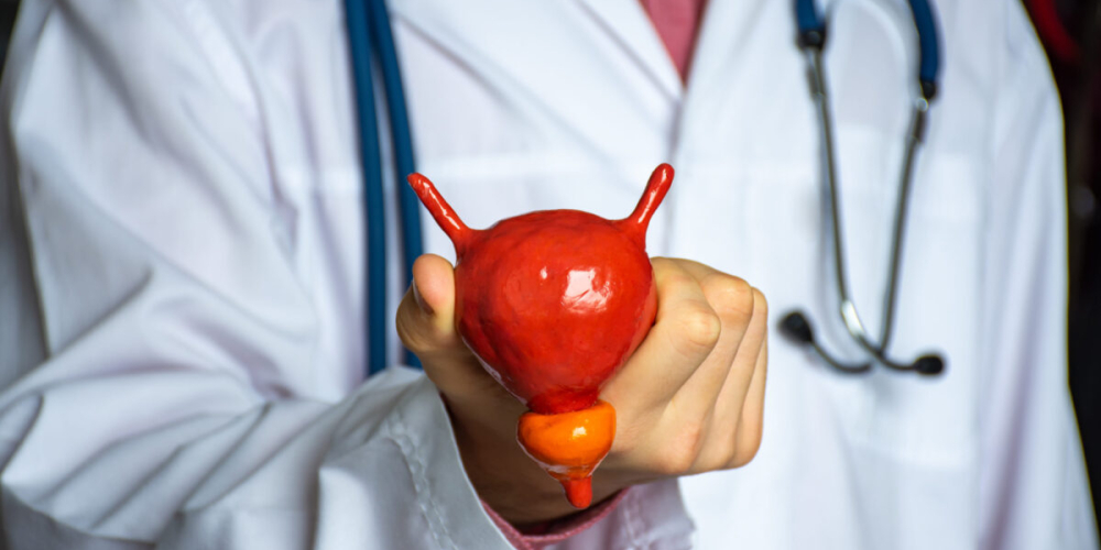 Аденома простати (гіперплазія передміхурової залози)