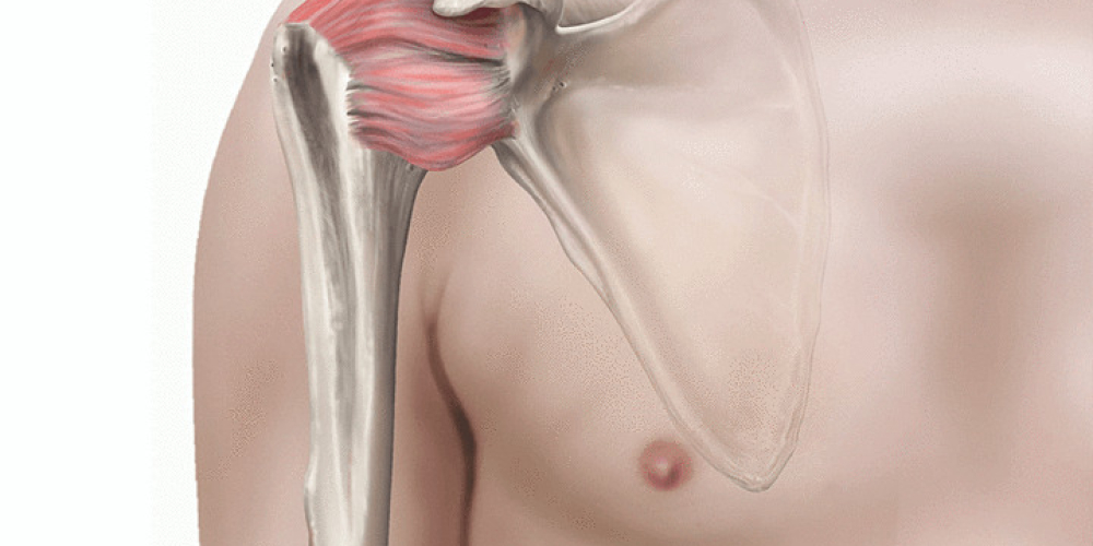 Адгезивный капсулит (синдром «замороженного» плеча)