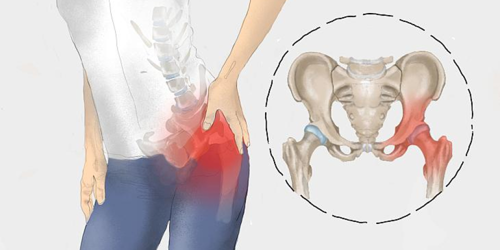Боль в тазобедренном суставе