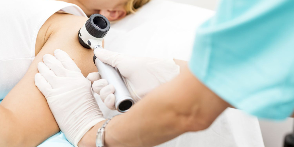 Дерматоскопия Дерматоскопия