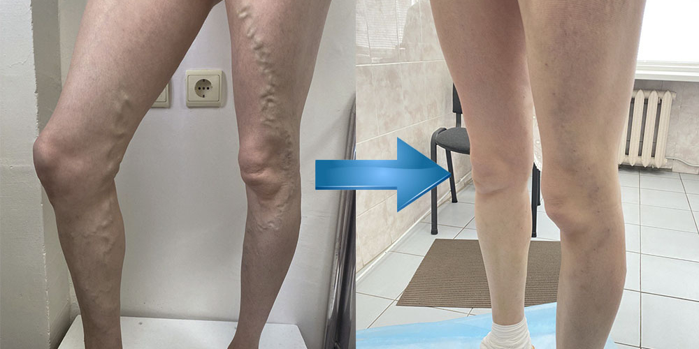 Сосудистая хирургия