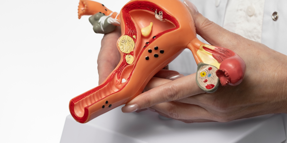 Эндометрит