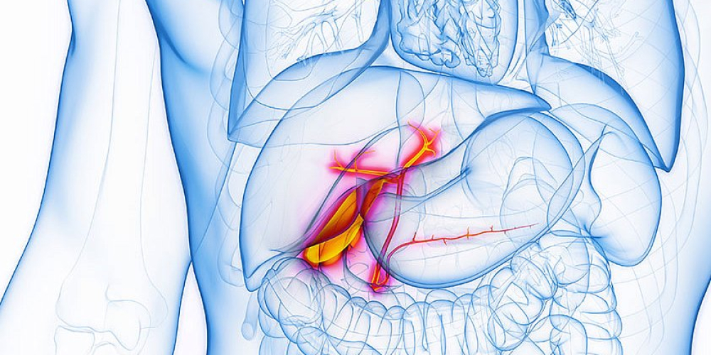 Холецистит Холецистит