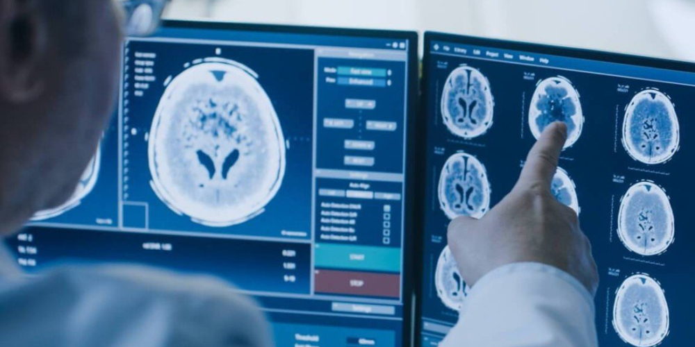 Церебральна нейрохірургія