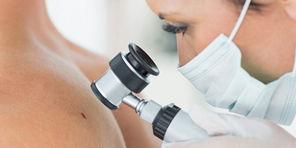 Дерматолог-онколог