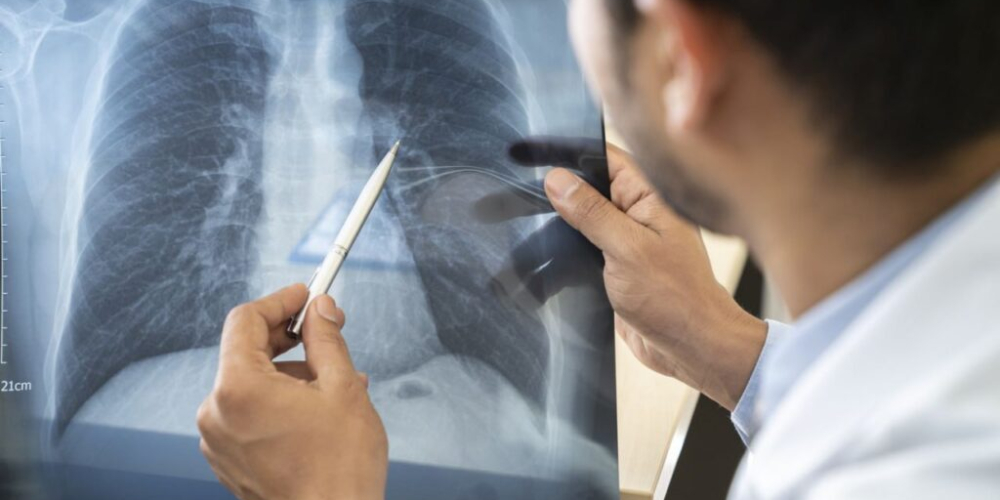 Пульмонолог