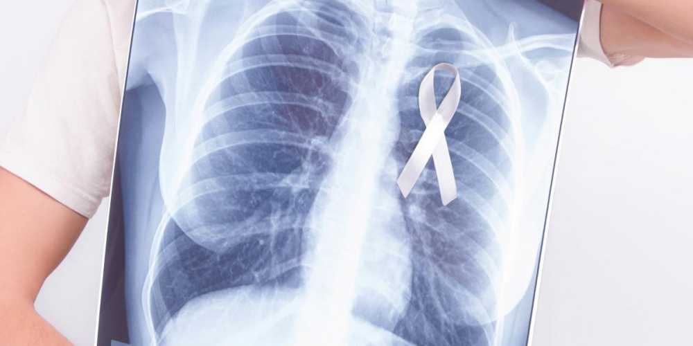 Рак легких