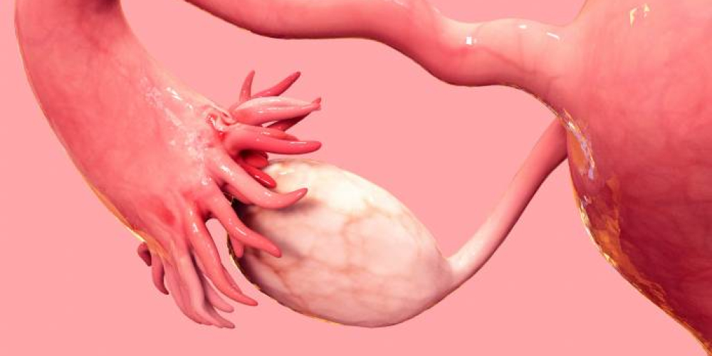 Рак маткових труб