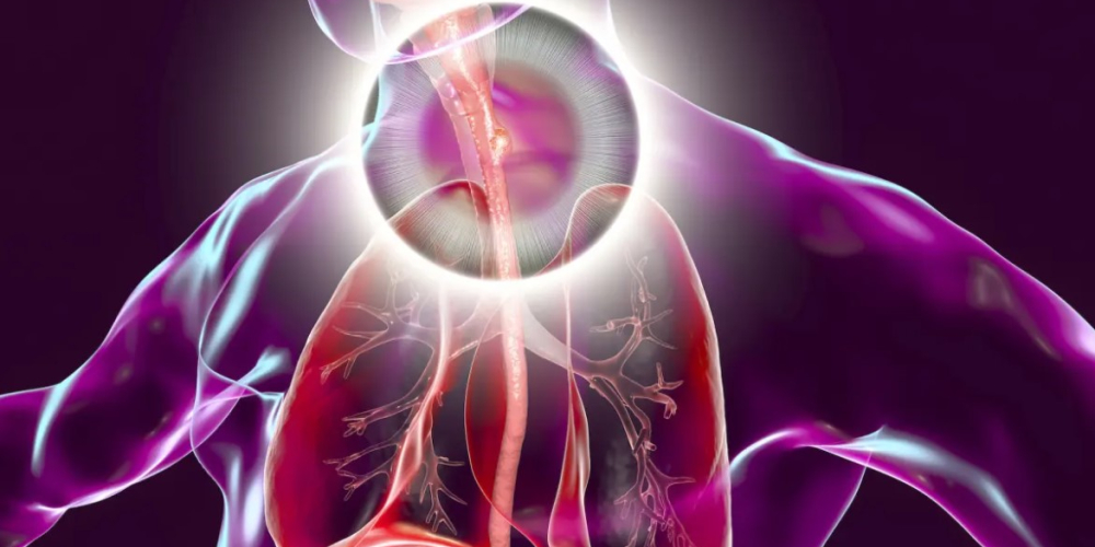 Рак пищевода