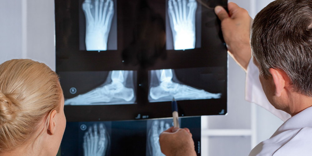 Рентген ноги