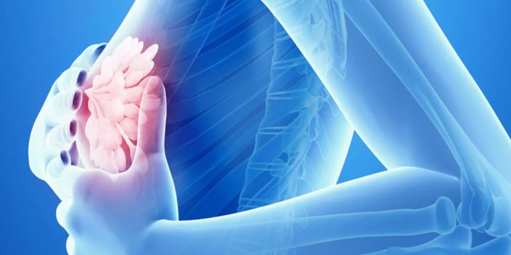 Маммология Маммология