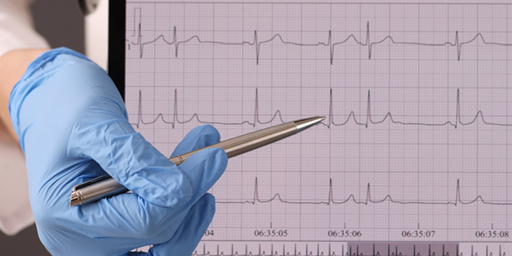 Стенокардія