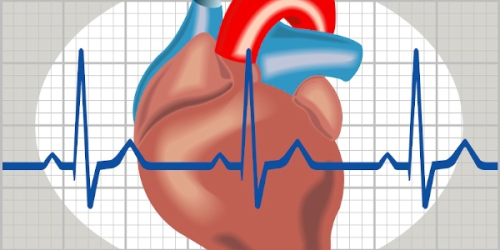 Тріпотіння передсердь