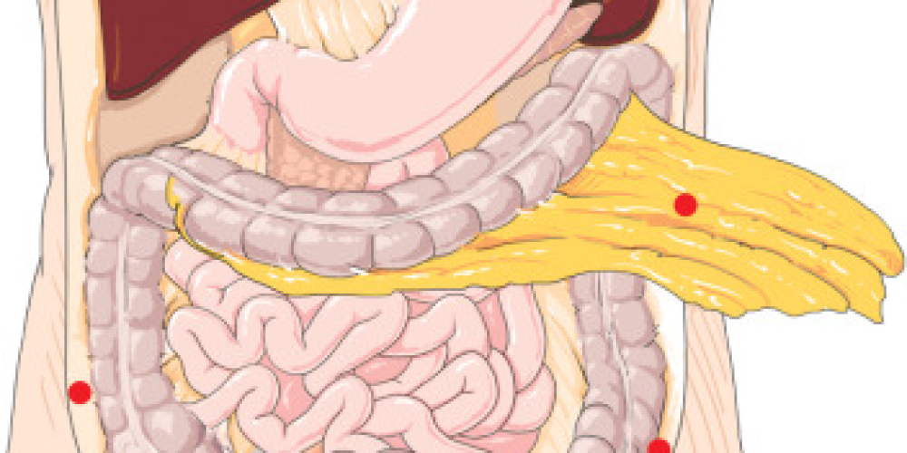 Супраколінна оментектомія