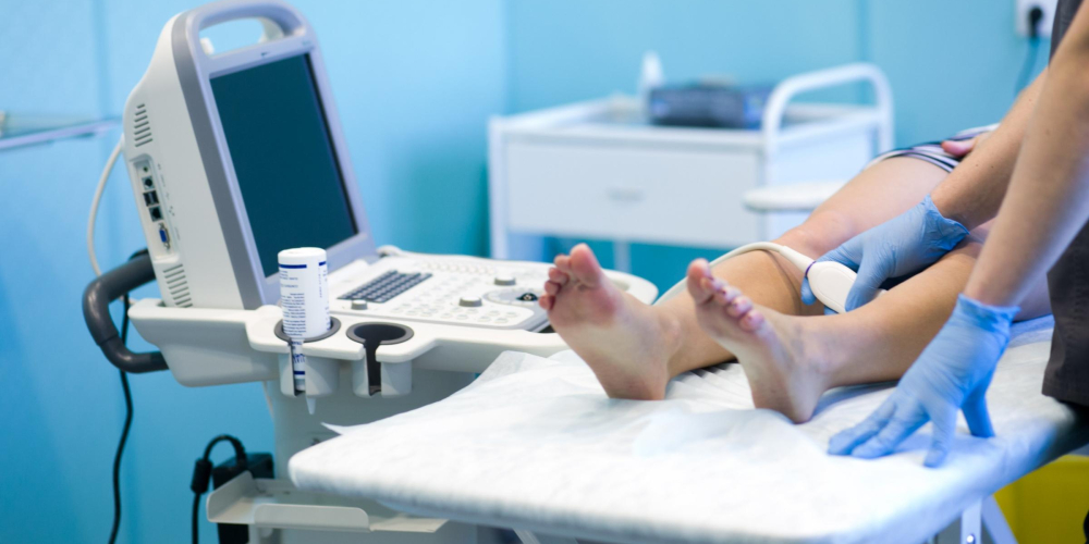 УЗИ сосудов нижних конечностей (вен и артерий)